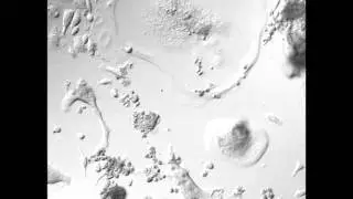 RAW 264.7 fusion to osteoclasts 2