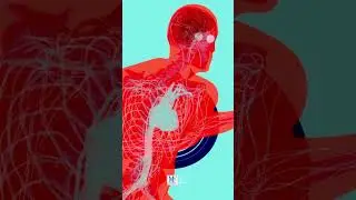 Heartburn and Weight Loss Surgery