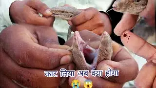चंदन गोह के काटने पर क्या होता || विष खोपड़ा से कटवा कर देखना पड़ गया महंगा 😱||monitar lizard bite
