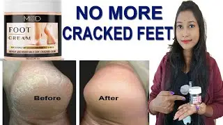 Mod Foot Cream for Cracked Heel | Treatment For Dry and Cracked Hell