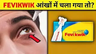 Fevikwik आंखों में चला गया तो क्या होगा।||Take Fact Mind||#fact