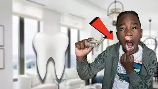 Money surprise from tooth fairy- Kash lost a tooth