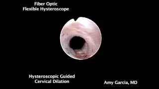 Hysteroscopic-guided cervical dilation