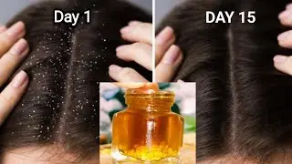 Winter Homemade Oil At Home / Neem Hair Oil For HairFall Control , Mathi Oil For Fast Hair Growth 