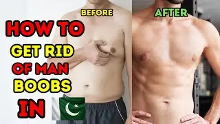 How to Lose Man Boobs -  Man Boobs Workout - How to Get Rid of Man Boobs - how to fix man boobs