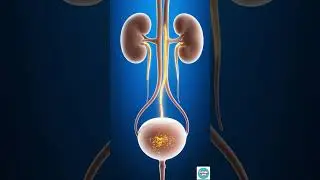 What Happens If You Hold Your Pee Too Long? #short