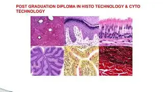 post graduation diploma in histo technology & cyto technology course in pune,bhosari
