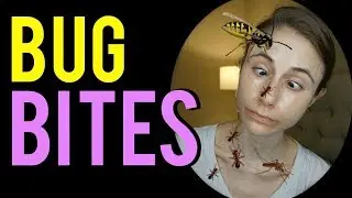 HOW TO STOP BUG BITES FROM ITCHING | Dermatologist @DrDrayzday