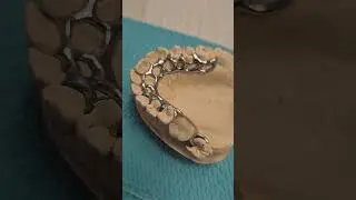 favorite dental clinic 💚протез з м&rsquo;яким кламером 🦷Наш сайт Favorite.dp.ua
