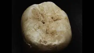 Ottica Rotante - Dente