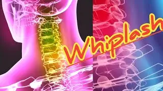 #shorts #vsmedicoclasses whiplash || Neck injury || vsmedicoclasses.