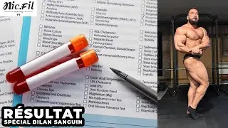 R&eacute;sultat Bilan Sanguin sp&eacute;cial | TRT | Low T | High E2 | Vlog