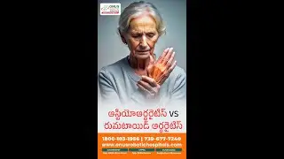 Osteoarthritis vs Rheumatoid Arthritis &ndash; Know the Difference Early!