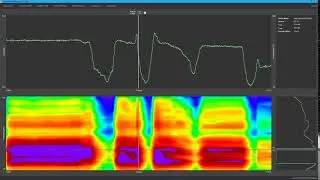 Ultrasound Leak Detection