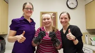 Mary Free Bed Engineers Custom Hands for Jodi