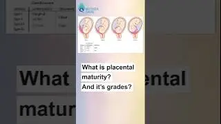 What is Placenta Maturity? | Dr Supriya Puranik #mothercare #drsupriyapuranik #placentamanturity