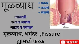 मूळव्याध म्हणजे काय?त्याचे लक्षणे, कारणे, प्रकार आणि मूळव्याध वरील उपाय उपचार आणि आहार 