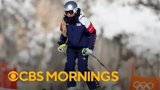 Lindsey Vonn undergoes surgery after crashing, breaking leg in race at Winter Olympics