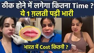 Urfi Javed Lip Fillers Video : कितना होता है Swelling Treatment और Cost ? Lip Fillers Side Effects
