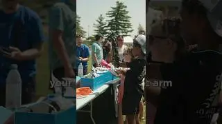 САМЫЙ ПРОДВИНУТЫЙ протез?!