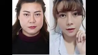 [Grand Plastic Surgery] Let's have a look on her amazing transformation