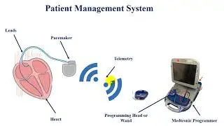 Part 14 Telemetry Antenna for Implantable Pacemakerهوائي القياس عن بعد لجهاز منظم ضربات القلب