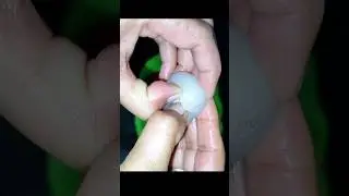 Rambutan Fruits #fruits #Shorts #shortsvideo #viarlshort #krishnakirasoi