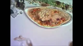 Инфузория туфелька под микроскопом.