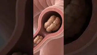 movement of constipated stool | Anatomy | Bio  Anatomy Ai #3danimation #shorts
