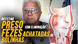 Fezes achatadas ou bolinhas ao evacuar saibam a causa ao vivo forma interativa c/Dr.Paulo Branco: