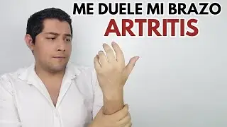 me duele mi brazo artritis don suculento suculentas donsuculento