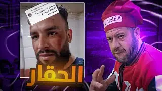 فضيحة الشاف البرمة