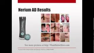 Nerium Business | 3 BIG MISTAKES | Boston MA | 888 979 3768