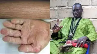 Cheikh Bop: Ndokhoum siti si une semaine lakoy fathi...