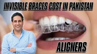 Cost of Invisible Braces in Pakistan | Invisalign Aligners Price | Dr. Shahzad Mirza | Best Dentist