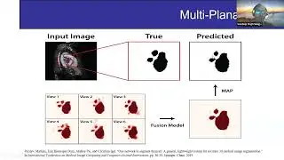 Deep Learning Frameworks for Clinical Diagnosis - a healthcare system