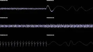 Chester Cheetah: Wild Wild Quest (GEN/MD) - Un-Clear Waters - In Oscilloscope View!