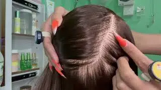 Extreme Scalp Cleaning ASMR | Dandruff Removal with Tweezers, Comb & Long Nails IMG 6718