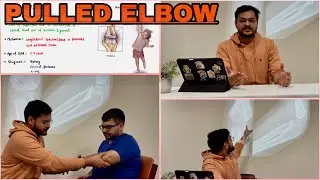 PULLED ELBOW 