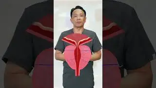 UROLIFT - Prostatic Urethral Life (PUL): Benign Prostatic Hyperplasia treatment
