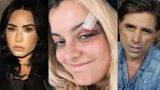 Celebs React To Bebe Rexha's Phone Throwing Injury