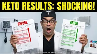 Keto Diet Blood Test Results Before and After a Ketogenic Diet : Couple Case Studies