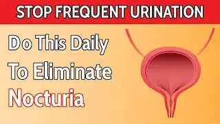 Top 8 Best Ways to Prevent Nighttime Urination 🚽🌙 (Nocturia Solutions)/ Health