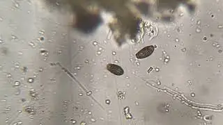 Coleps? 
