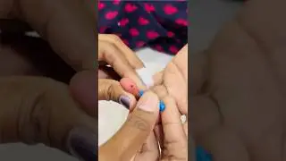 Testing Blood Suger On Dr. Morepen Gluco One Glucometer || Accu Chek Active Sugar Testing Machine