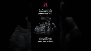 Baby Trampoline