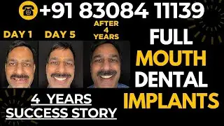 Best Dentist in Mumbai | ✨ Truly Life-Changing Treatment Experience - Dr Mayur Khairnar