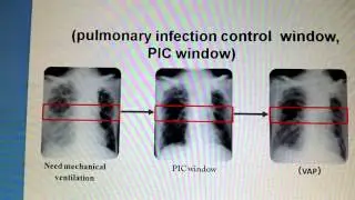 AECOPD or COPD patients with pulmonary infection &ndash; Video abstract 96541