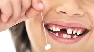 Definition of Milk deciduous or temporary and Permanent  Dentition   Teeth