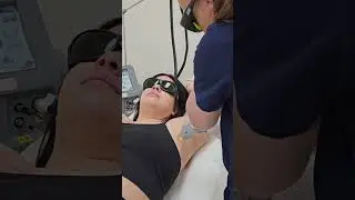 Laser Hair Removal with Candela GentleMax Pro #shorts #laserhairremoval #naperville